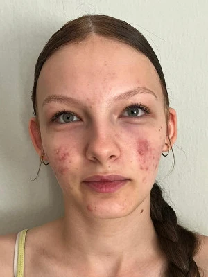 Michaela  Tonhajzerová